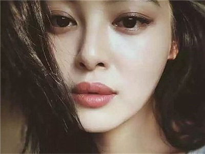 辛芷蕾是兔唇吗 厚嘴唇反而成为她办辨识度高的一点