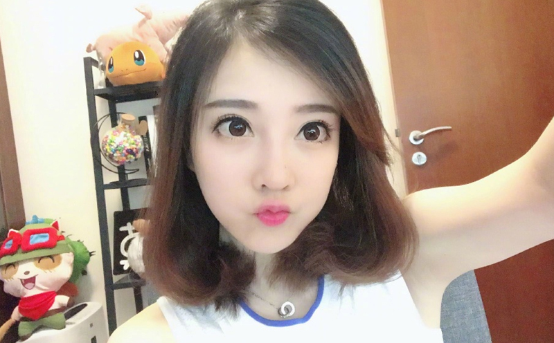 冯提莫整容后照片