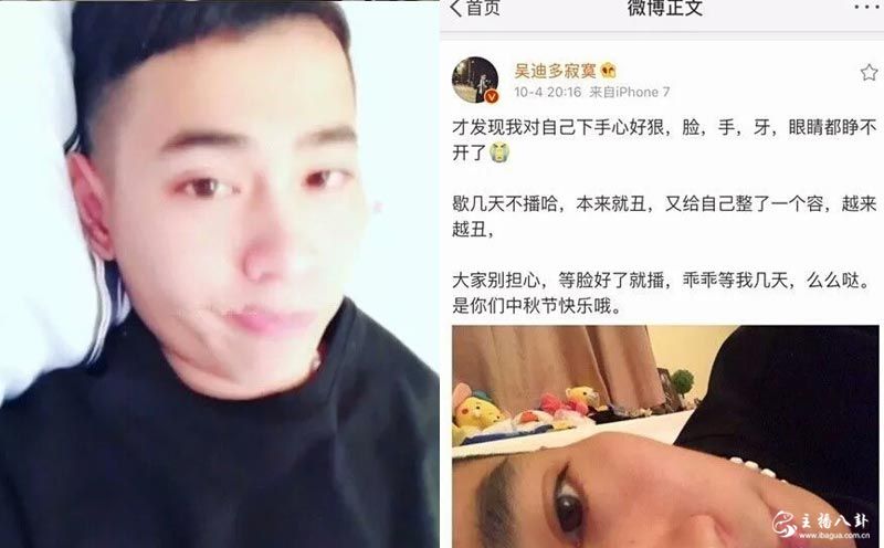 快手：吴迪心态爆炸！直播狂扇自己耳光！