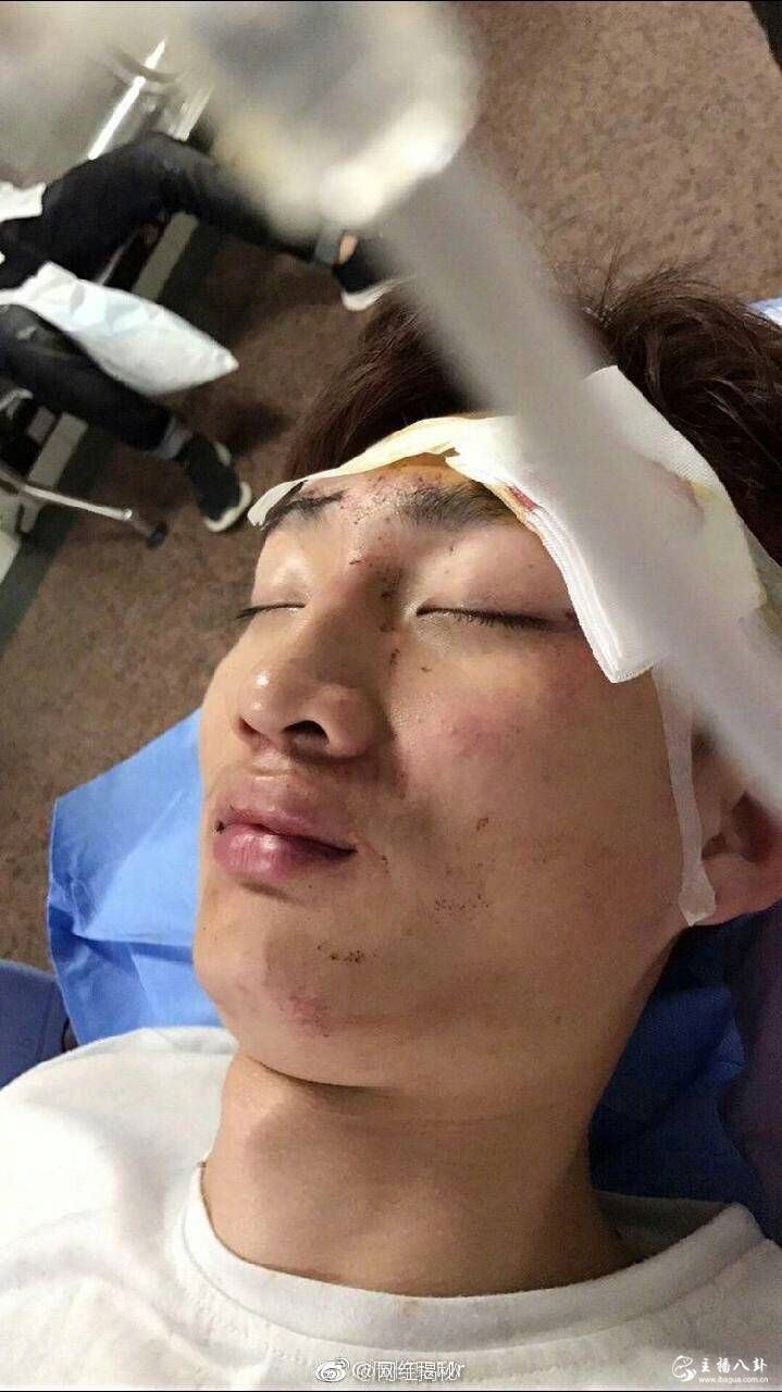 王逗逗前男友遭街头暴打！是方丈指示的！？