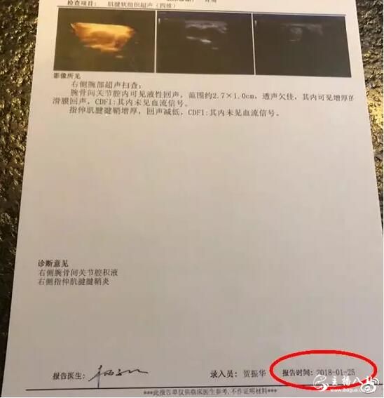 阿哲