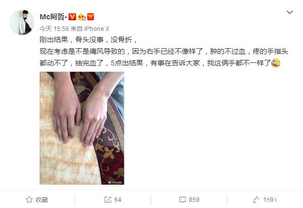 负伤上阵！阿哲放话：只要嘴不坏，直播照旧不耽误！