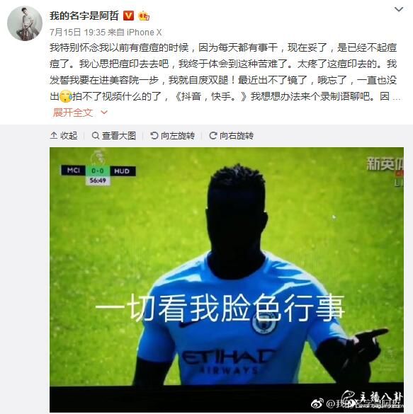阿哲发文：抖音、快手都不能拍了，最近不能出镜？