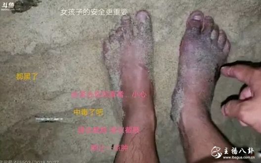 彡彡九户外慌张中毒