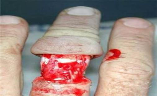 戴戒指打保龄球