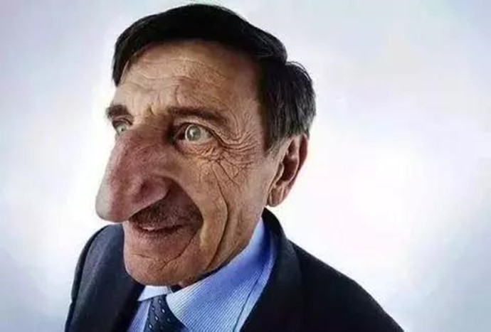 世界上最大的鼻子