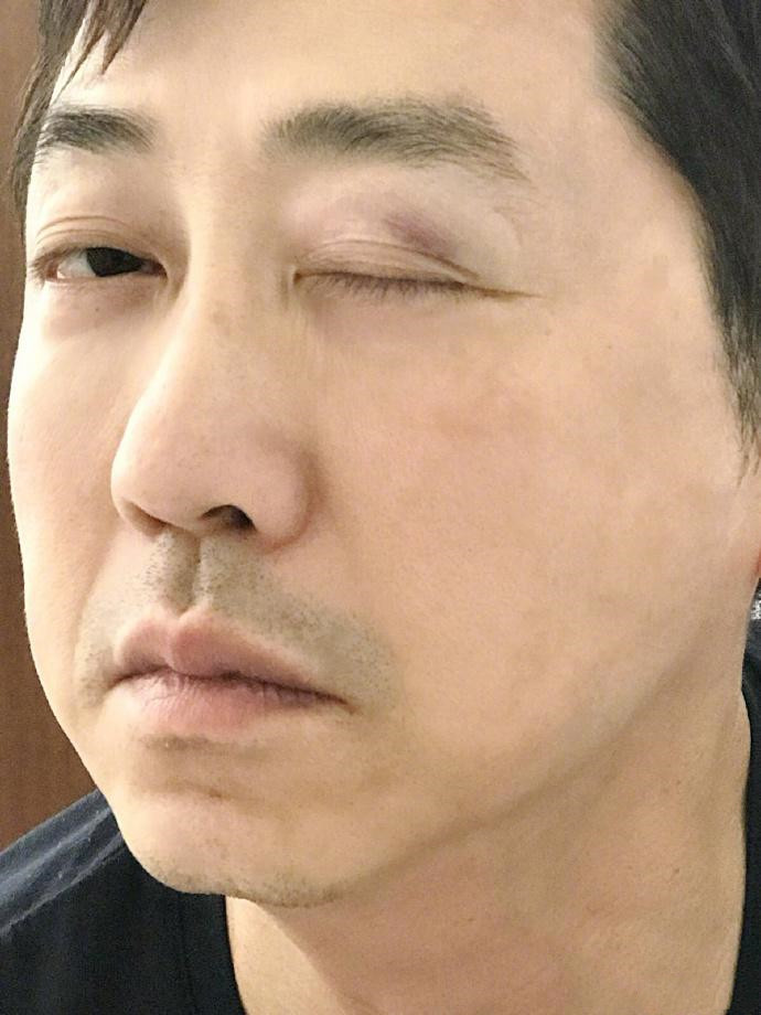 庾澄庆被亲闺女打眼睛
