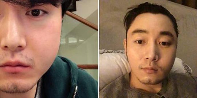 李东学毁容照片