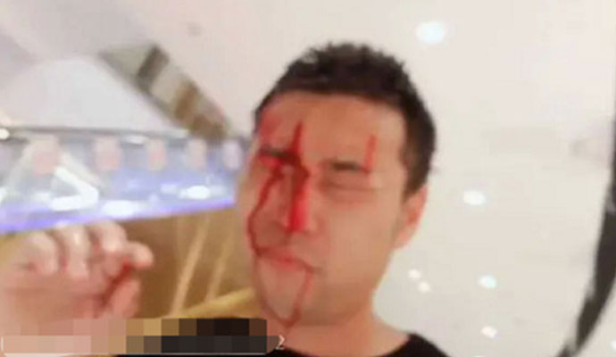 钱小佳被打照片