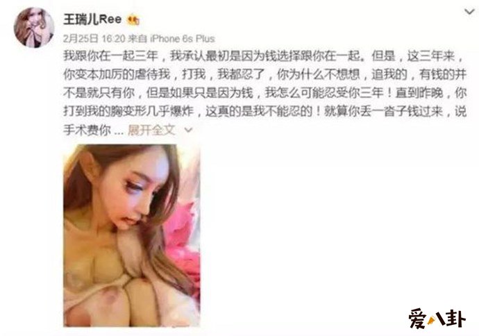 张爱朋前女友控诉张爱朋家暴