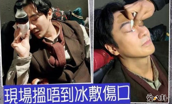 孙耀威被打伤眼角