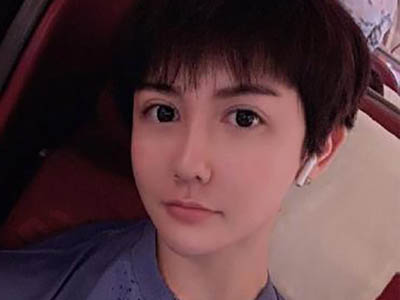 蛇精男刘梓晨 其现况如何据说现在大变样是真的吗