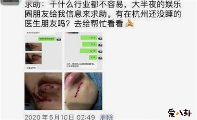 网曝范丞丞洗澡摔倒
