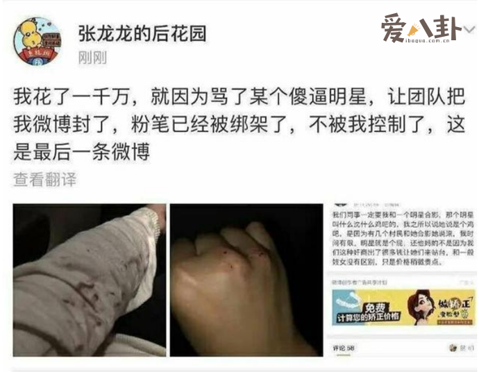 张小龙曝光沈梦辰耍大牌