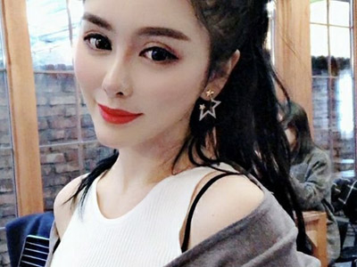 七哥张琪格现状起底 她整容失败了吗为何变丑了