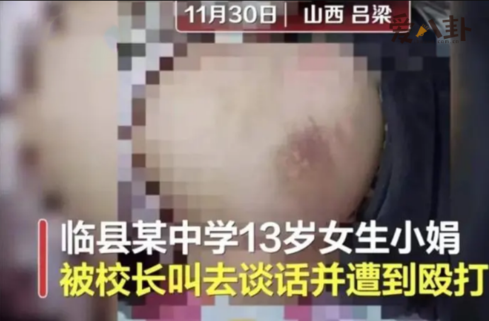 女生被校长殴打致伤