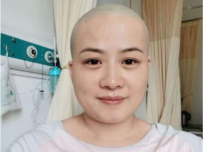 岳云鹏老婆回应生病剃光头 她得了什么病身体现状如何