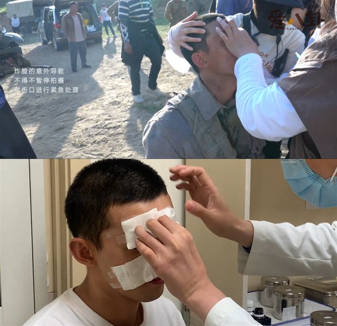 吴磊拍马战炸伤脸