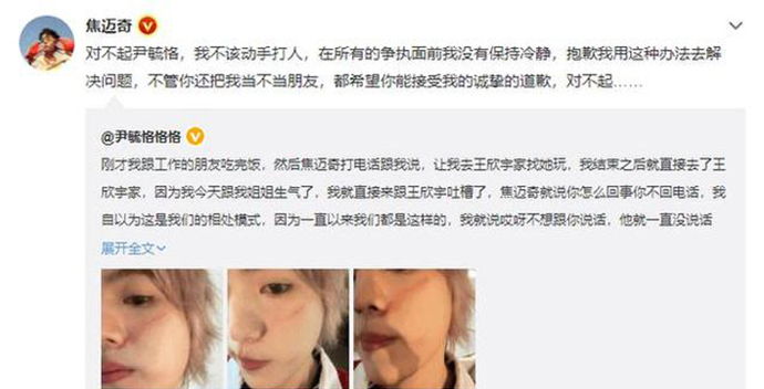  焦迈奇为什么打尹毓恪